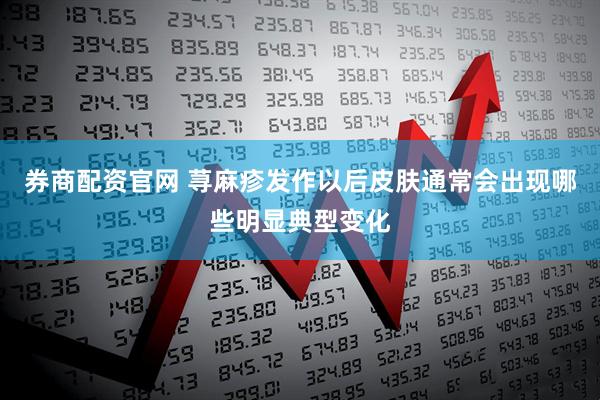 券商配资官网 荨麻疹发作以后皮肤通常会出现哪些明显典型变化